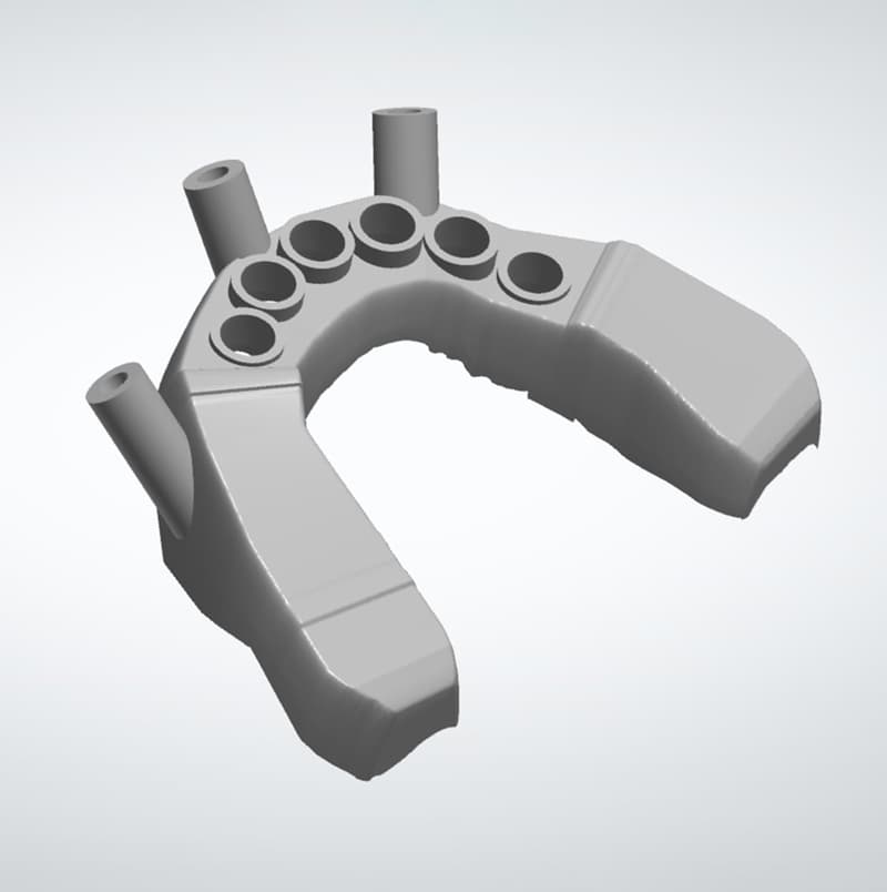 3D model of a drilling template for implants