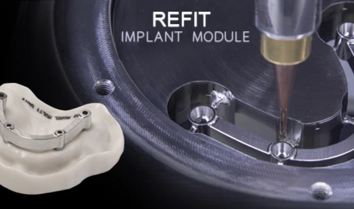 リフィットインプラントモジュール imes-icore