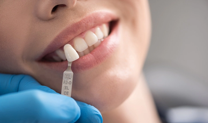 Lithiumdisilikat in der digitalen Zahnmedizin