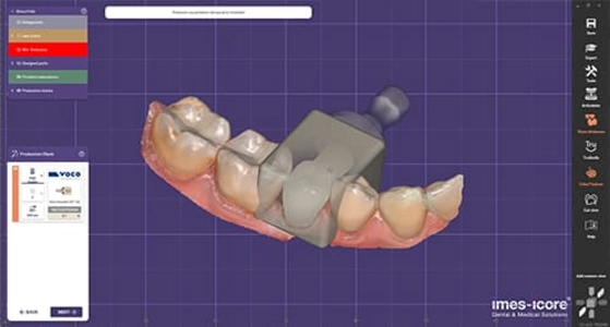 CAD/CAM DENTAL for dental prostheses of the highest precision