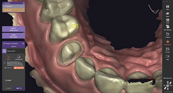 CAD/CAM DENTAL for dental prostheses of the highest precision