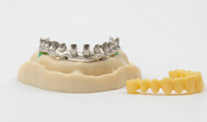 Image of dental prostheses using telescopic technique.