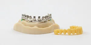 Image of dental prostheses using telescopic technique.