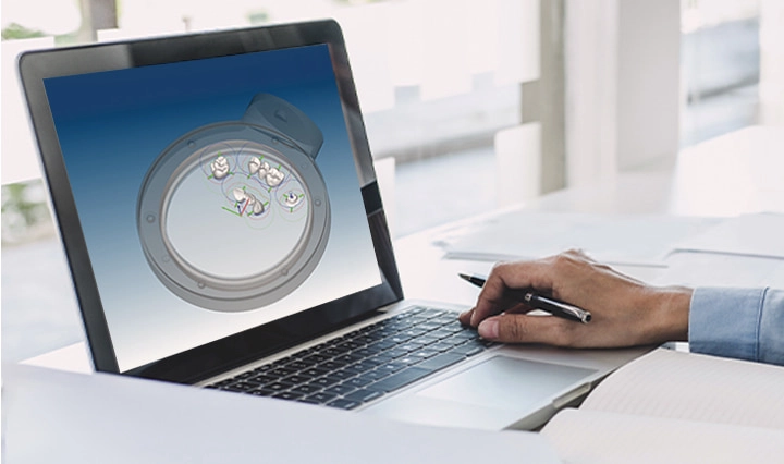 Traceability in Digital Dental Workflows