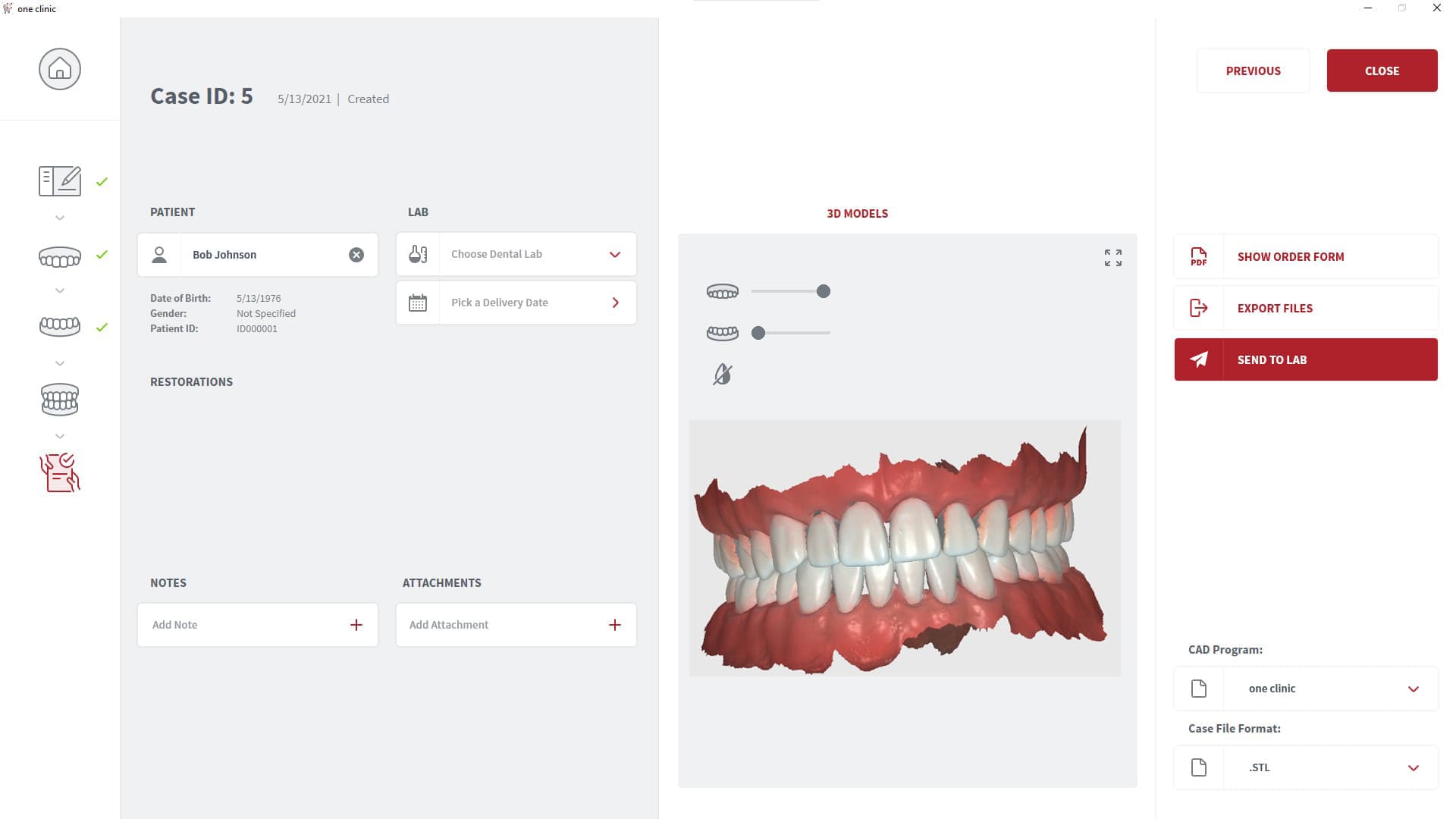 CORiTEC ione scan - One Clinic - Bite Alignment