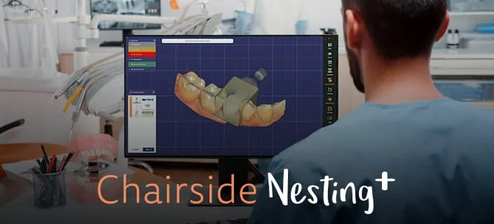 CAM-Nesting in der Praxis