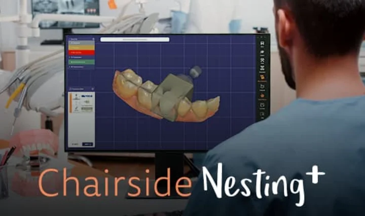 CAM-Nesting in der Praxis