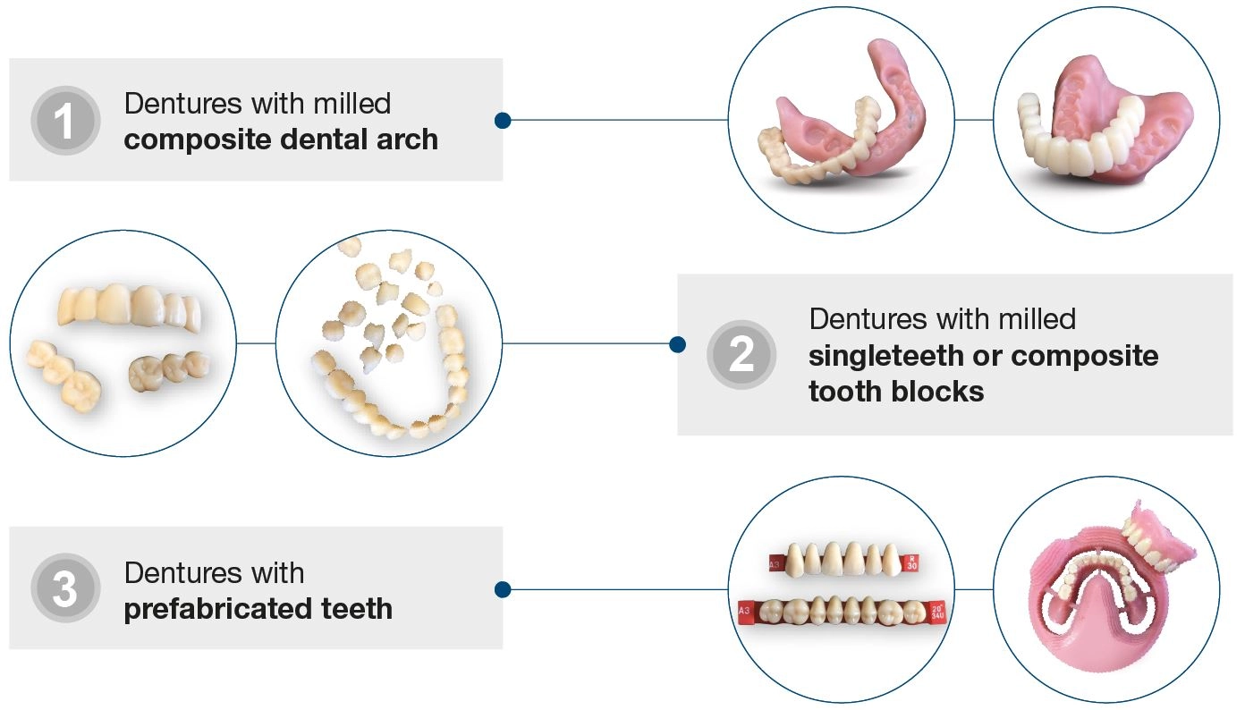 Production of all kind of complete dentures: smartDenture workflow
