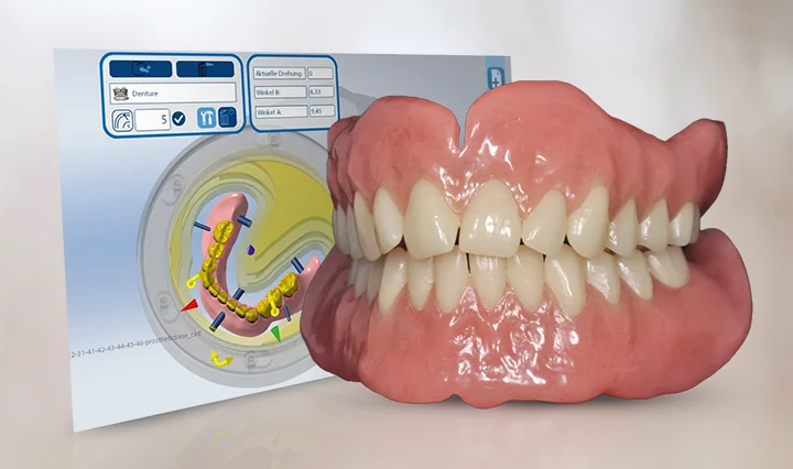 smartDenture Workflow: Automated Complete Denture Milling with iCAM V5
