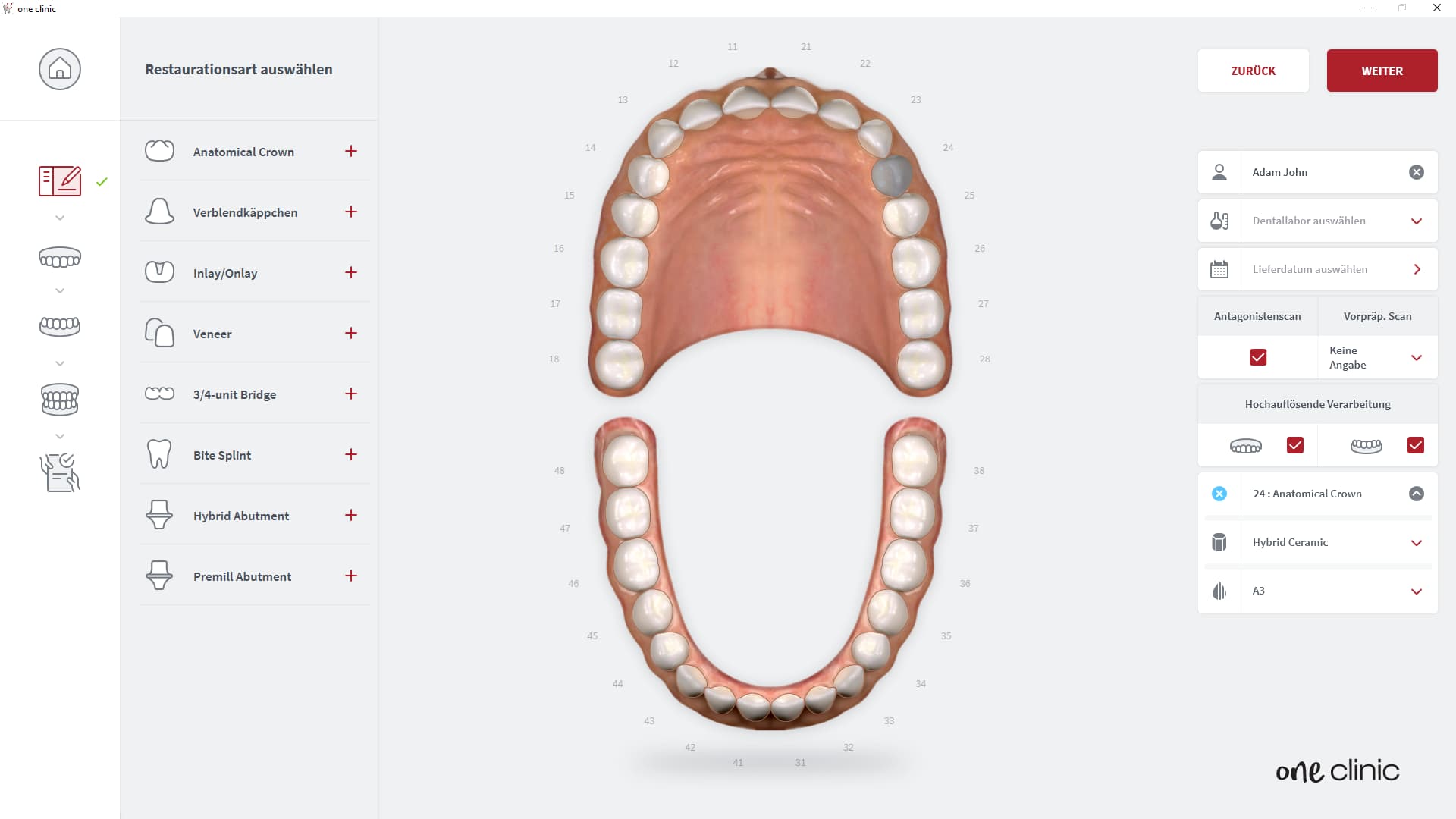 CORiTEC ione scan - One Clinic - Neue Auftrag