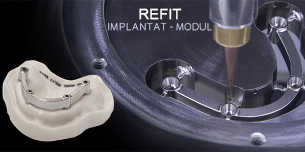 iCAM V5 smart – ReFit Implantat-Modul – imes-icore